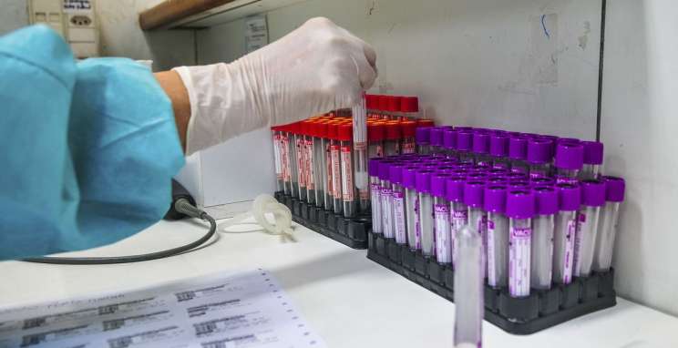 CIC-BG estuda detalhes sobre perfis de infectados pelo Covid-19 na Serra